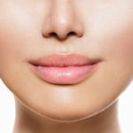 A girl underwent a Lip Enhancement procedure.